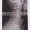 hot sale Konida fuji dry film medical x-ray film agfa digitizer Dental