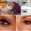 Quality promotional rf eyes care and removal dark circle