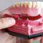 REMOVABLES | DENTURES   Elite Denture