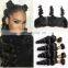 burmese virgin hair different types of curly weave hair lace frontal with bundles