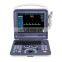 Portable 3D 4D Convex Scanner Color Doppler Ultrasound Machine for hospital