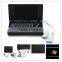 Cardiac Urology Measurement laptop Ultrasound Scanner for convex linear micro-convex transvaginal rectal probe option