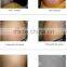 Your need's Best Effect cavitation RF fat froze body slimmming machine
