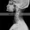 HC-D017 CCD Based Uc-Arm Digital X-ray Machine /X Ray Equipment/Digital Machine