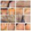 Hair Removal Machine Shr Elight With CE