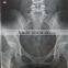FUJI XRAY FILM DI-HT CHINA MANUFACTURE