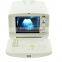 Factory price of 10 inch display white and black ultrasound machine for pregnancy