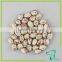 White and Red Speckled Kidney Beans Xinjiang Round Type