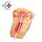 HC-S317 Female contraceptive model intrauterine contraception and training model/intrauterine device model