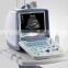 best selling portable ultrasound scanner for many desease
