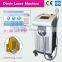 lumenis lightsheer duet laser diode 808nm diode laser permanent hair removal