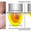 FDA Approved Warts Removal New Fractional Co2 Skin Resurfacing Birth Portable Mark Removal RF Laser Portable Machine Ultra Pulse Vagina Cleaning