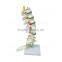 Life-size 5 Pcs Anatomical Lumbar Vertebra Model