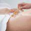 Disposable Smooth Hair Removal Body Care Waxing Stick For Women