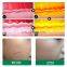 China medical scar removal skin resurfacing rejuvenation vaginal laser tightening equipment tube fractional co2 laser machine