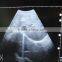 CE approved Portable Ultrasound Scanner with 3.5Mhz multi-frequency convex probe RUS-9000E