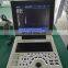 Portable 15 inch 2d 3d 4d Color Doppler Ultrasound Scanning Machine black and white scanner for hospital use
