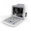 12 inch  Portable Full Digital 2D/3D/4D  Medical Ultrasound Instruments for Hospital use