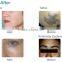 Best IPL SHR system with CE certificate Apolomed model HS-665