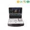 MY-A024A Medical 3D Color Doppler Ultrasound Machine Portable PC Ultrasound Scanner for SALE