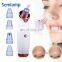digital facial blackhead and whitehead remover vacuum face skin pore clean