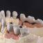 PFM-Bridges-Crowns  China Dental Laboratory - Outsourcing Dental Lab