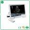 B Mode Portable Ultrasound Price TS20