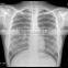 Laser FilmDry Medical Film