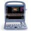 Sonoscape S2 portable ultrasound machine low cost portable ultrasound machine