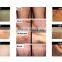 Perfect cooling system 808nm diode laser hair removal machine