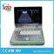 CE & ISO Certificated Best Portable Ultrasound Machines , B/W Ultrasound Scanner Machine