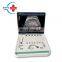 HC-A006A  3D Ultrasound scanner machine full digital portable 15inch PC based Laptop  3D  Ultrasound scanner machine