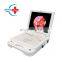 HC-I040C 17 inches big screen HD quality Portable ENT endoscope camera with LED light source for medical ENT