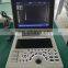 Hot selling laptop black and white medical latest ultrasound machine for hospital