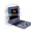 Ce certification Portable 15 inch physiotherapy ultrasound  color doppler ultrasound for hospital use