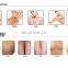 2020 Niansheng Factory Portable 808nm diode laser hair removal machine price superior