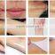  china kes med 140c beauty machine big e light