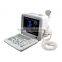 Large Screen Good Image Full Digital Portable Ultrasound Scanner Machine with Probe-External Workstation (80 element)