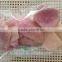 Vaccum Fried VF dried Vegetables-VF dried Onion Crisps for sale
