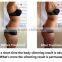 liposuction machine plastic surgery equipment Vacuum Suction Devices Type Liposuction