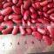 2015 Dark Red Kidney Bean