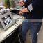 2015 Newest Auto Motor RF Fractional Micro Needle Machine in RF Equipment