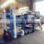 Professional sale of pharmacy of filter press
