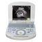 New hot selling portable ultrasound scanner / ultrasound machine suitable clinic community