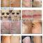 Ultra pulse Pigmentation Removal CO2 laser resurfacing machine