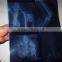 35*43cm Agfa films DT2B made in china for hospital agfa blue sensitive filmagfa x-ray film