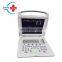 Digital portable ultrasound scanner for sell