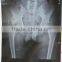 China supplier cheap medical film(10x12inch) for agfa drystar drypix