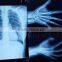 HD Medical Film Special Ink