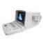 Portable Ultrasound Scanner----CE Approved Ultrasound Machine